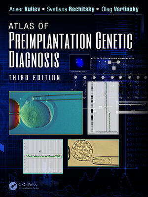 cover image of Atlas of Preimplantation Genetic Diagnosis